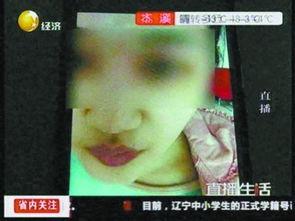 注射隆鼻视频,视频带你了解注射隆鼻的神奇魅力